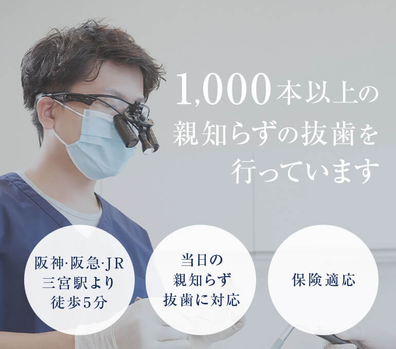 神戸三宮谷歯科クリニックでは1,000本以上の親知らずの抜歯を行っています